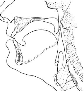 Schematische Darstellung der Sprechorgane